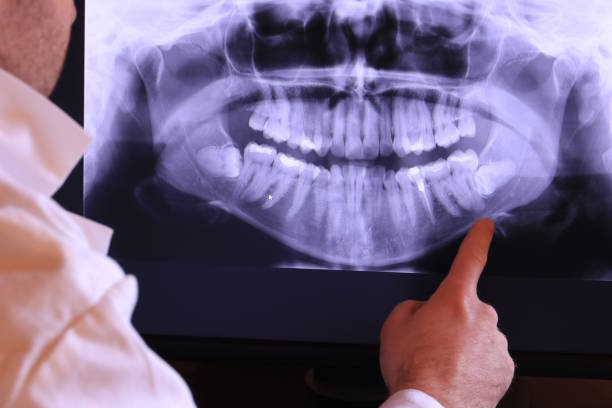 Best Chipped Tooth Repair Near Me  in Columbus, KS