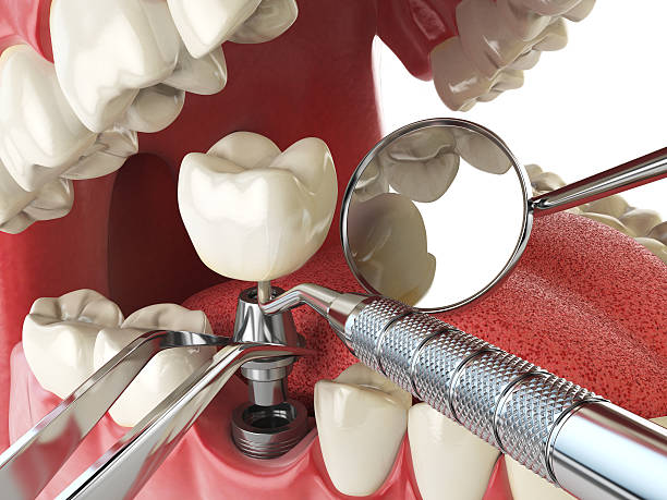 Best Urgent Tooth Repair  in Columbus, KS